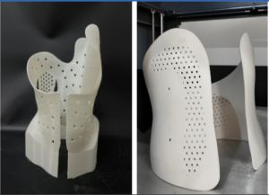 Medical 3D Printing: Transforming Patient Care with Precision Additive Manufacturing